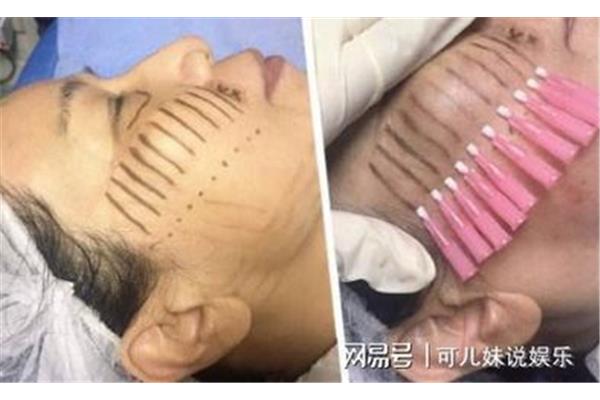 Eye 埋线多久可以化妆,done 埋线多久可以化妆